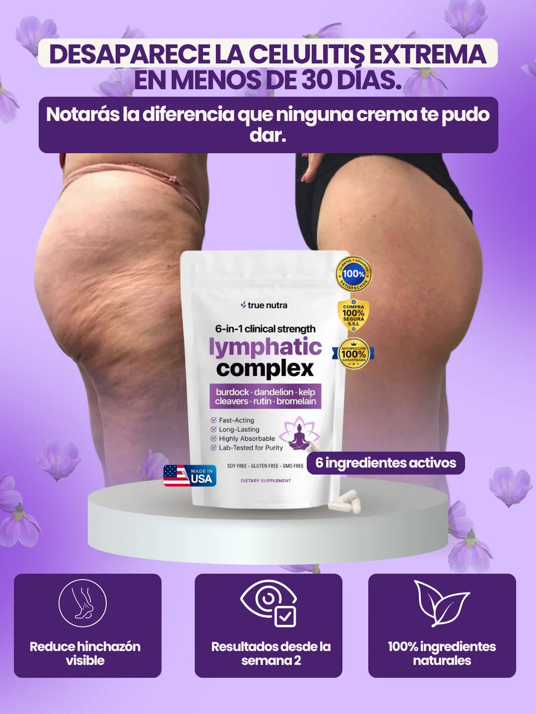 Lymphatic Complex | Muestra tus Piernas sin Pena
